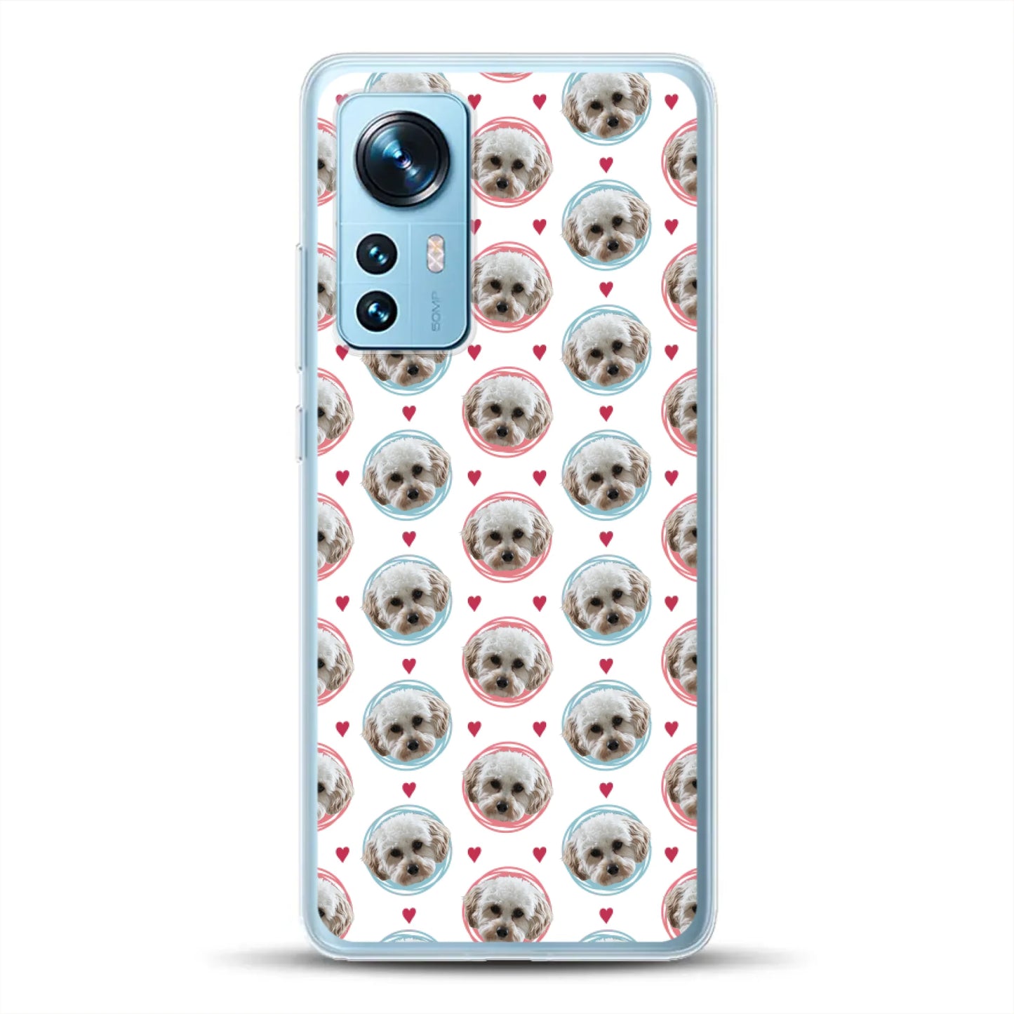 Pattern Me - Individuelle Handyhülle für Xiaomi