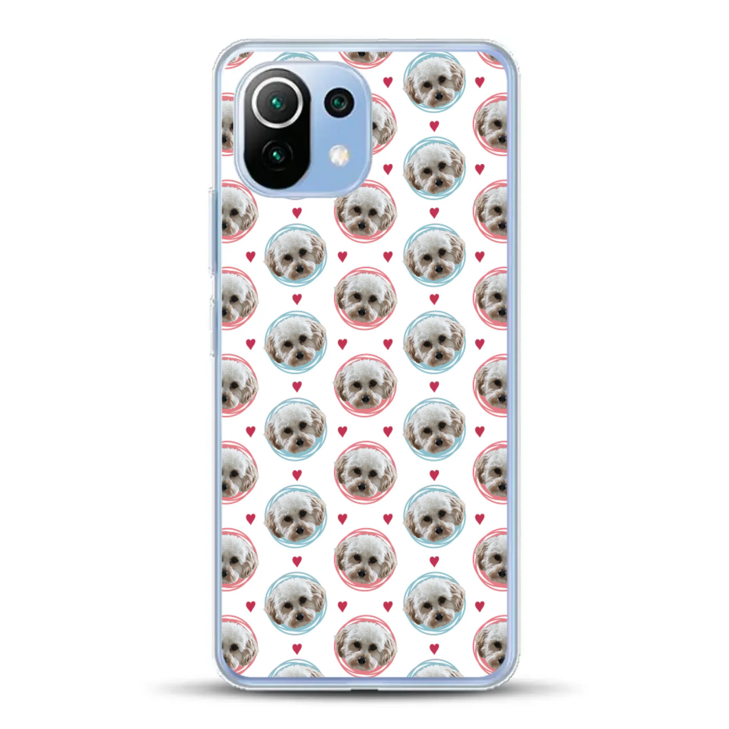 Pattern Me - Individuelle Handyhülle für Xiaomi