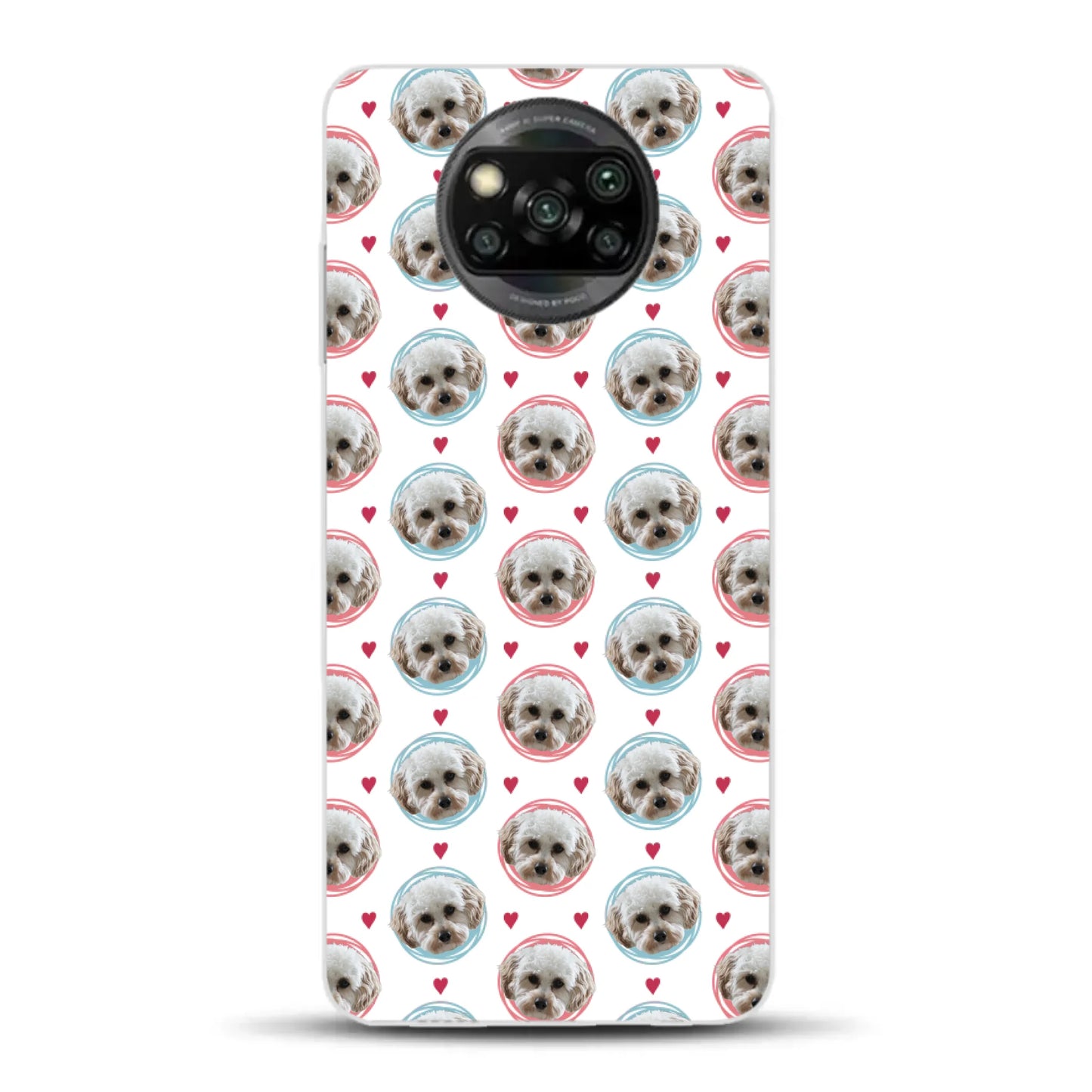 Pattern Me - Individuelle Handyhülle für Xiaomi